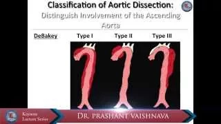 [Keynote Lecture] Acute type B aortic dissection: insights from IRAD