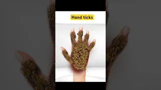 Hand ticks removal #asmr #animation #youtubeshorts #satisfyingasmr #shortsvideo #viralvideo
