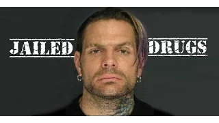 10 Things WWE Wants You To Forget About Jeff Hardy
