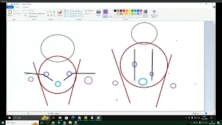 Morcstar │ ZvZ [CHOKE/BRIDGE] Battle Formation