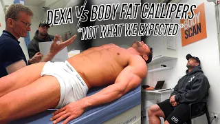 DEXA SCAN VS BODY FAT CALIPERS