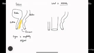 Vaginal Reconstruction in Vaginal Agenesis | MRKH Syndrome | Amenorrhoea | Dr Jay Mehta, Mumbai