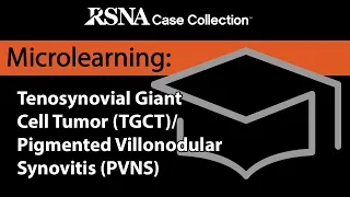 Microlearning Curriculum Series: TGCT/PVNS