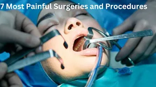 7 Most Painful Surgeries and Medical Procedures