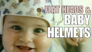 Pediatrician Explains: Plagiocephaly (Flattening of Head) and Helmeting (Baby Helmets)