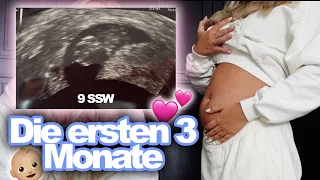 Ersten Ultraschallbilder, Übelkeit & Veränderungen 🤰🏼 Eure Fragen zum 1. TRIMESTER / 1-13 SSW | Dagi