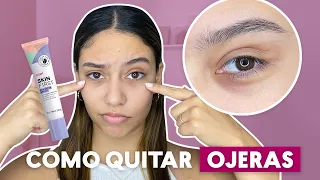 Cómo quitar las ojeras | Rutina Skin Care | Cyzone​