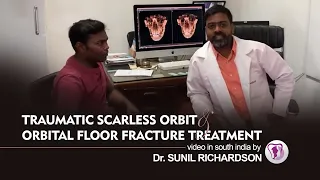 Orbital Floor Fracture Repair Simplified | Oculoplastic Facial Accident Surgery in India