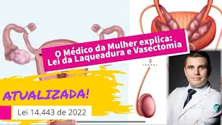 Lei da Laqueadura e Vasectomia ATUALIZADA 2022