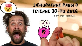 Заживление раны в течение 30-ти дней (Не для слабонервных😁)