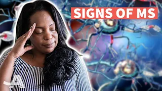 Early Signs of Multiple Sclerosis