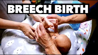 HE COULD NOT LOWER HIS LEGS AFTER BIRTH! (Frank Breech) | Dr. Paul