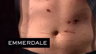 Emmerdale - Aaron's Bloodstained Stomach Is Revealed