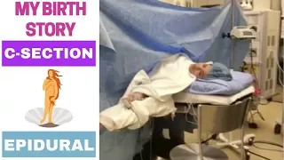 MY BIRTH STORY || EPIDURAL || C-SECTION || INDUCED LABOUR