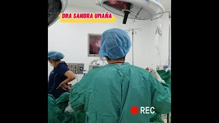 Cirugía por Video LAPAROSCOPIA