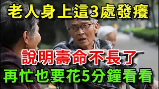 老人身上這3處「發癢」，說明壽命不長了！如果你一個都不占，活到100歲沒問題！【書恆說事】