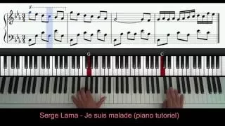 Serge Lama - je suis malade (piano tutoriel)