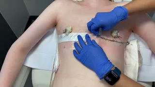 Post-Op Dressing Removal