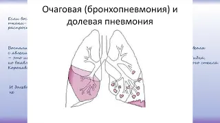 Пневмония. Причины, Симптомы и признаки, диагностика, лечение.