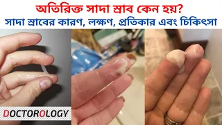 অতিরিক্ত সাদা স্রাব কেন হয়? সাদা স্রাবের কারণ,লক্ষণ, প্রতিকার এবং চিকিৎসা