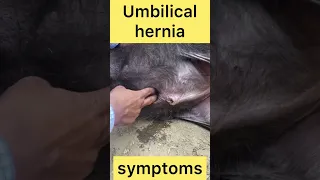 Symptoms of umbilical hernia l dr umar khan