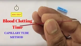 Blood Clotting Time Determination by Capillary Method | आपका खून कितने समय में जमता है कैसे पता करें