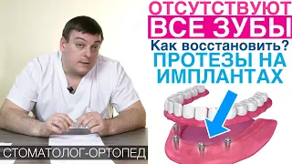 Восстановление зубов протезами на имплантах - All on 4, All on 6. Зубные протезы на имплантах.