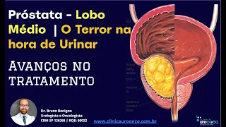 O Terror do Homens na Hora de Urinar | Lobo Mediano da prostata | Como diagnosticar e tratar