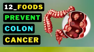 12 Superfood's PREVENT COLON POLYPS