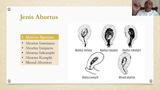 ABORTUS | Dr. dr. Mangatas Silaen M.K.M, Sp.OG | Fakultas Kedokteran Universitas Prima Indonesia