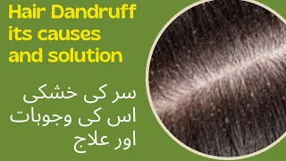 سر کی خشکی اس کی وجوہات اور علاج Hair Dandruff Its Causes and Solution