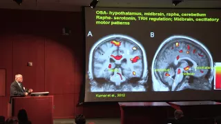 CNS Reorganization in Cardiac Disease