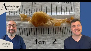 10.5CM/4IN EAR WAX & MASSIVE KERATIN PLUG REMOVAL- EP820