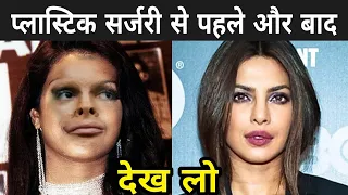 प्लास्टिक सर्जरी से पहले और बाद की 10 बॉलीवुड अभिनेत्रियां | 10 Actresses Before and After Surgery