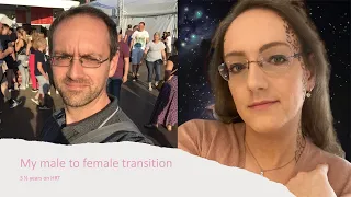 My Male to Female Transition Timeline | 3 1/2 years on HRT