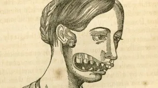 The Messed Up Truth About The Radium Girls