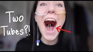 ♡ Two Tubes? How To: Place an NG Tube! | Amy Lee Fisher ♡