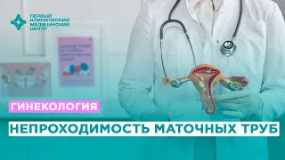 Лечение непроходимости маточных труб