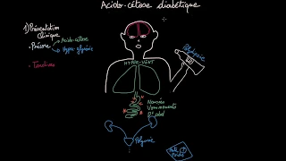 Acido-cétose diabétique - Clinique - Diagnostique - Prise en Charge - Partie 2 - Docteur Synapse