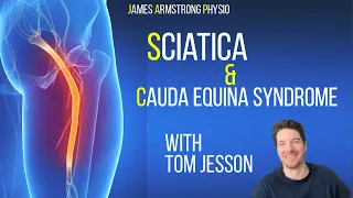 Understanding Sciatica and Cauda Equina Syndrome with Tom Jesson