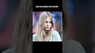 Cara Delevingne Before and After Drugs #caradelevingne #cara #shorts #drugs #tiktok #fyptiktok