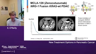 New Treatment Options in Pancreatic Cancer