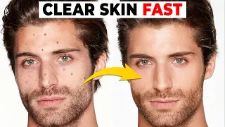 5 Habits That Are DESTROYING Your Skin | Alex Costa