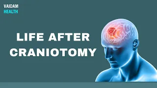 Life After Craniotomy