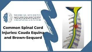 Common Spinal Cord Injuries: Cauda Equina and Brown-Sequard