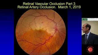 Retinal Artery Occlusion