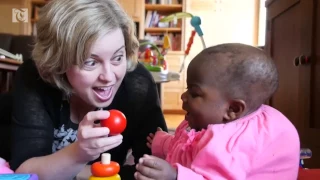 Baby Dominique born with four legs, now has two