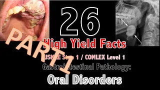 26 High Yield Facts for USMLE Step 1/COMLEX Level 1: GI Pathology Oral Disorders Part 1