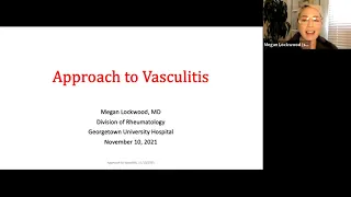 Vasculitis