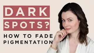 Treating Hyperpigmentation - How To Fade Acne Marks, Melasma and Dark Spots | Dr Sam Bunting